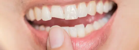87 1