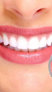 Beautiful Young Woman Smile — Albany Dental in Gosford, NSW