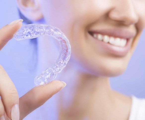 Teeth Whitening Tips from Dentist at Gosford