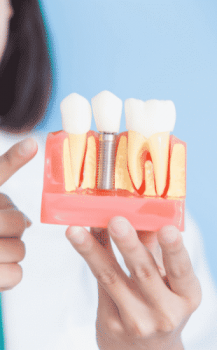 dentist pointing at dental implant