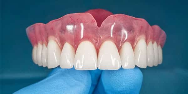 dentist holding up dentures
