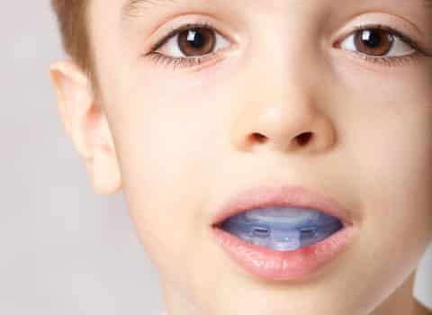 Sport Mouthguard In Children — Dentist In Gosford, NSW