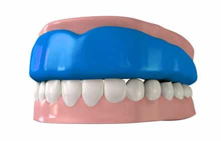 Custom Mouthguard— Dentist In Gosford, NSW