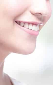 woman smiling with perfect white teeth