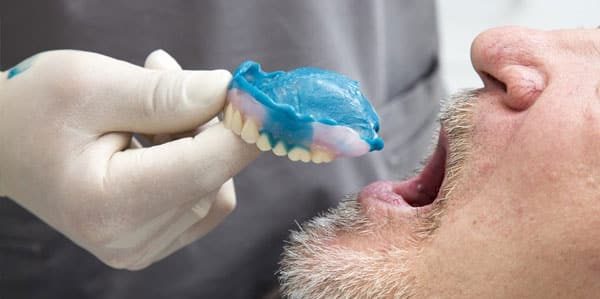 dentist inserting dentures
