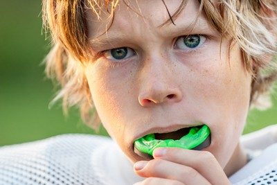 Custom Fitted Sports Mouthguards