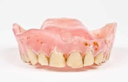 close up damaged teeth and gums